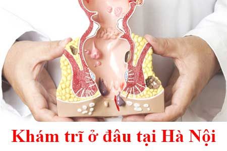 khám trĩ ở đâu tại hà nội