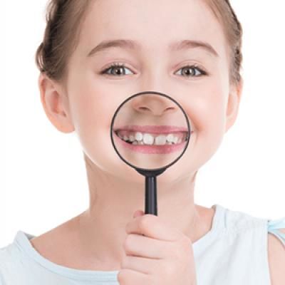 見た目でジャッジ！歯の【白斑】は虫歯になりかけサイン！